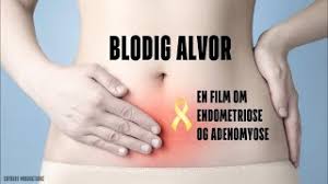 Van wikipedia, de gratis encyclopedie. Blodig Alvor En Film Om Endometriose Og Adenomyose Fullversjon Med Norske Tekster Youtube
