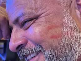 Fundraiser by Carol Rubio : Stand by Albert with Faith and Hope