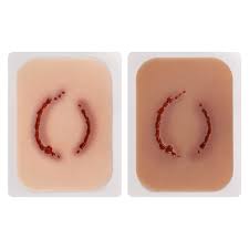 Image result for Human Bite