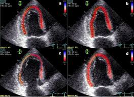 The objective of the adjusting the level tube is to make the vertical axis truly. Eypzoicfcevw0m