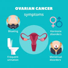 Ovarian cancer refers to any cancerous growth that begins in the ovary. Ovarian Cancer Signs And Symptoms Autism Treatment Trust