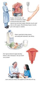 Some people do not have any signs or symptoms at all. Vaginal Cancer Spectrum Health
