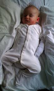 Wet Wraps For Eczema How To Do Wet Wrapping Eczema Kids Baby Eczema Eczema