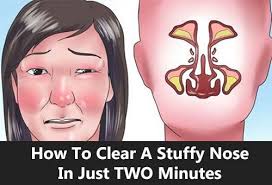 Check out our exclusive interview with linda kelly from women ascend here · read more about: How To Clear A Stuffy Nose In Just Two Minutes Stuffy Nose Remedy Stuff Nose Remedies Stuffy Nose