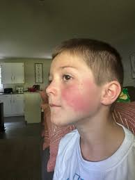 Moms! Jackson started breaking out