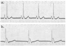 Image result for J Wave