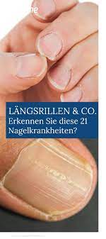 Nagelkrankheiten Erkennen Was Verfarbungen Co Bedeuten Nagelpilz Selbsttest Krankheit