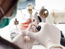 Benefits of an On-Site Dental Lab