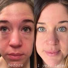 With so many treatments available, pick what makes your heart skip a beat!  Schedule your visit at Skin Lylee and indulge in some well-deserved  pampering! See you soon! Love, Amber. www.skinlylee.com