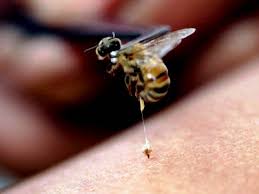 A single bee sting for me is a matter of discomfort and pain for about 30 minutes to an hour and a day or two of swelling. How To Treat A Bee Sting Mybeeline