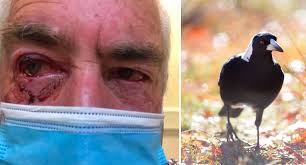 See more of magpie attack eye injury support on facebook. Magpie Attacks Man S Eyes Inflicting Horrific Injuries