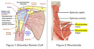 In this episode of eorthopodtv, orthopaedic surgeon randale c. Shoulder Blade Squeeze Arthritis Nsw