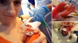 Mum mistakes 658g newborn son for placenta as he's born 16 weeks premature 
