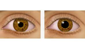 Image result for Pupil