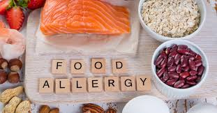 An allergic reaction occurs when the immune system mist. The Five Most Common Food Allergies Scl Health