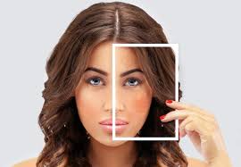 Les taches pigmentaires