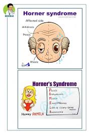 Anhidrosis — comprehensive overview covers symptoms, causes, treatment of this inability to sweat normally. Medical Likes Photos Facebook