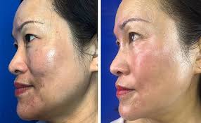 Musely Face Rx Prescription Anti Aging Made Simple Start Your Online Visit Today Musely Anti Aging Beauty Skin