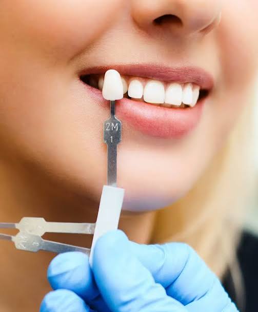 Same-day CEREC crowns at North Kamloops Dental