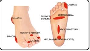 The metatarsals are the long bones located in our feet, between the tarsal (ankle) bones. Orthotics Treatment To Help Eliminate Your Foot Pain Foot Solutions