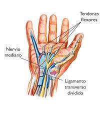Sunset and sunrise times in carpiano. Sindrome Del Tunel Carpiano Carpal Tunnel Syndrome Orthoinfo Aaos