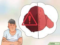 Prendre son temps aux toilettes et ne pas forcer l'évacuation des selles. 4 Manieres De Analyser Ses Selles Wikihow