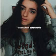 Dixiedamelio En Su Vsco Era