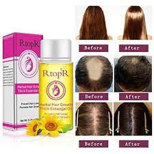 Some researchtrusted source found that peppermint oil promoted hair growth more effectively than topical applications of saline, jojoba oil, and minoxidil. Amazon Com Hair Oil Shouhengda Herbal Hair Growth Thick Essential Oil Anti Hair Loss Promote Hair Growth Repair Dry And Frizzy Hair Beauty