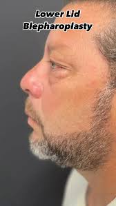 Andre Levesque M.D. (@doctorlevesque) • Instagram photos and videos