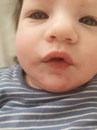 Is there an antihistamine to give a 6 month old when trailing allgery foods  to have