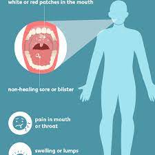 Oral cancer is a type of head and neck cancer that affects the mouth, gums, inner lining of the cheeks, and/or tongue. Oral Cancer Signs Symptoms And Complications