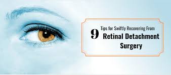 Retinal detachment causes, signs and symptoms, prevention, surgery & repair. 9 Tips For Swiftly Recovering From Retinal Detachment Surgery Samarth Eye Care