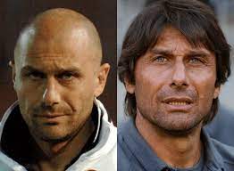 Antonio conte, il trapianto di capelli non è un mistero. Antonio Conte Il Trapianto Di Capelli Dell Allenatore Di Calcio