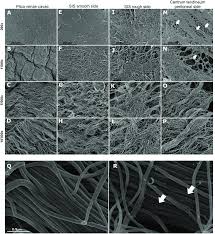 Find juan manuel fornasari credit information on allmusic. Sem Micrographs Of Porcine Collagen Membranes A D Show Different Download Scientific Diagram