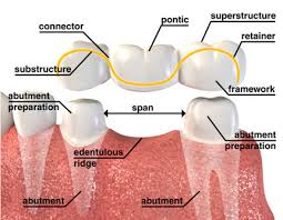 This is not a cheap treatment and while it's impossible to give you an exact price we try to show you a few factors. Dentist Crown Cost Dental News Network