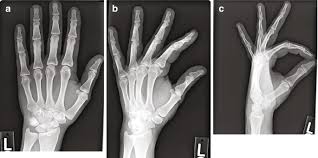 Image result for Hand Exam