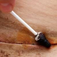 Keadaan kulit bagi mereka yang obesiti lebih tebal. Tips Cepat Sembuh Luka Urut Dan Penjagaan Pantang Facebook