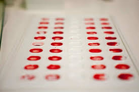 What blood type is immune to norovirus. Your Blood Type May Influence Your Vulnerability To Stomach Flu Genetic Literacy Project
