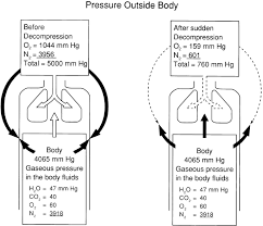 Image result for Decompression Sickness Management