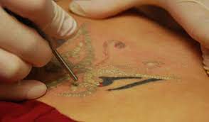 Laser tattoo removal in jupiter & miami. Miami Center For Cosmetic Dermatology Dr Deborah Longwill Tattoo Removal In Miami Miami Tattoo Removal