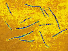 Image result for Treponema