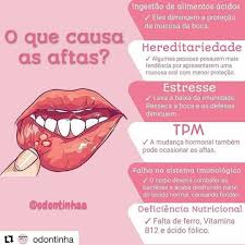 Pin De Karine Belo Em Sorria Em 2020 Tratamento Odontologico Marketing Odontologico Assistente De Dentista