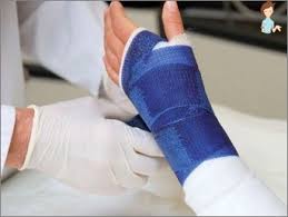 العلاج الطبيعي لليد بعد الجبس