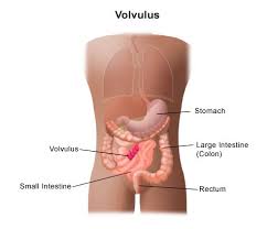 Image result for Volvulus