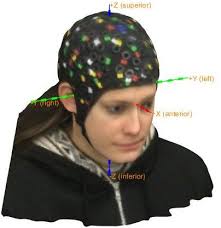 Automatic detection of fiducials landmarks toward development of an  application for EEG electrodes location (digitization): Occi