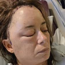 Fundraiser by Amanda Dutcher : Support Gwen's Recovery from Brain Bleed