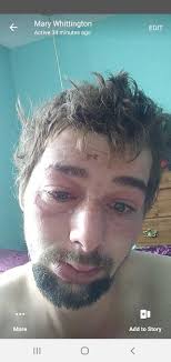 Finished the bike and rider.....no more burns! 😂