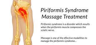 What Is Piriformis Syndrome Example Grow Health