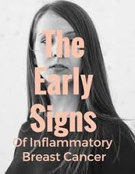 Inflammatory breast cancer is a particularly aggressive form of breast cancer that presents with symptoms of inflammation. 11 Canser Ideas Rakovina Prsnika Rakovina Bolesti Chrbta