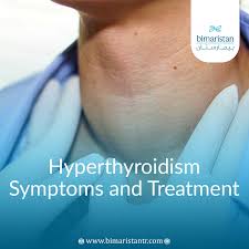 Image result for Hyperthyroidism Management